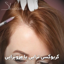 کربوکسی تراپی مو بهتر است یا مزوتراپی